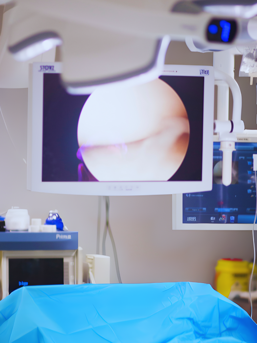 Athroscopy Arthroscopy Equipment
